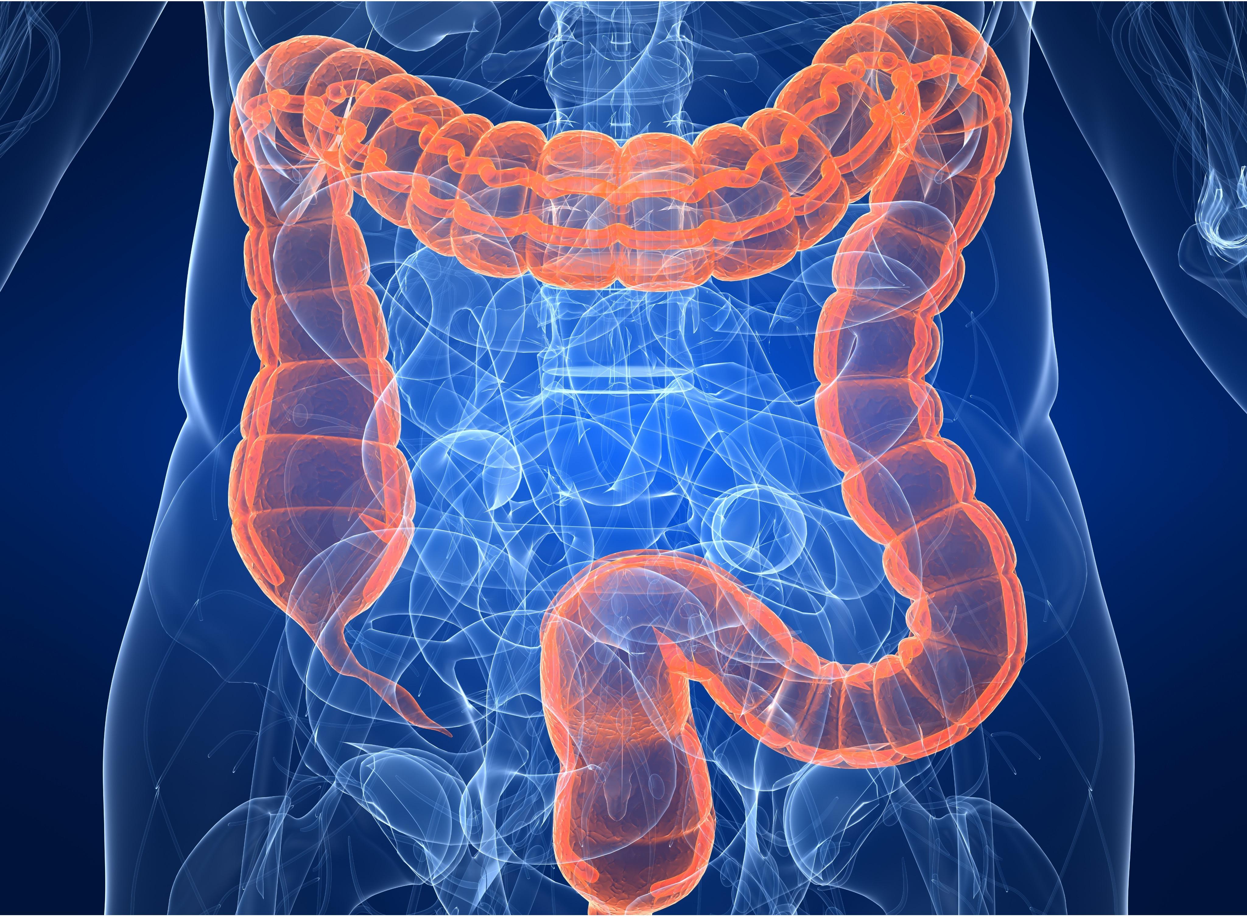 Colorectal Cancer Treatment